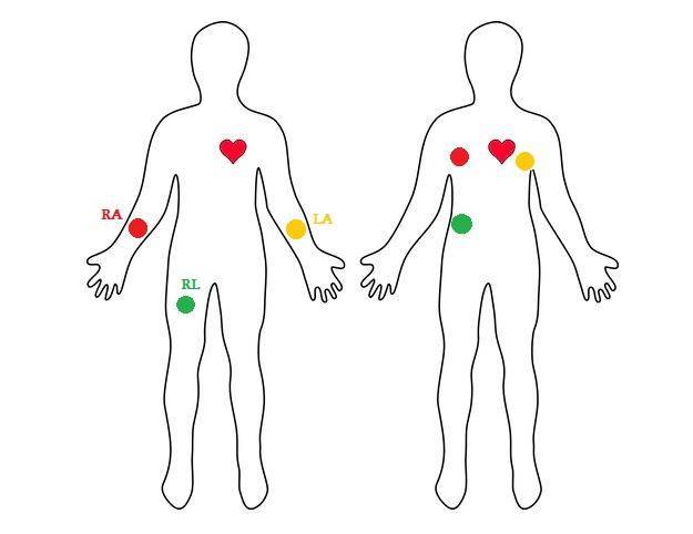 Heart Rate Monitor Kit with AD8232 ECG sensor module